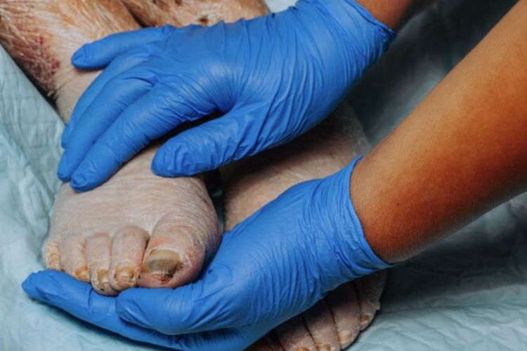 Smarter Healing Paths For Diabetic Foot Care In India