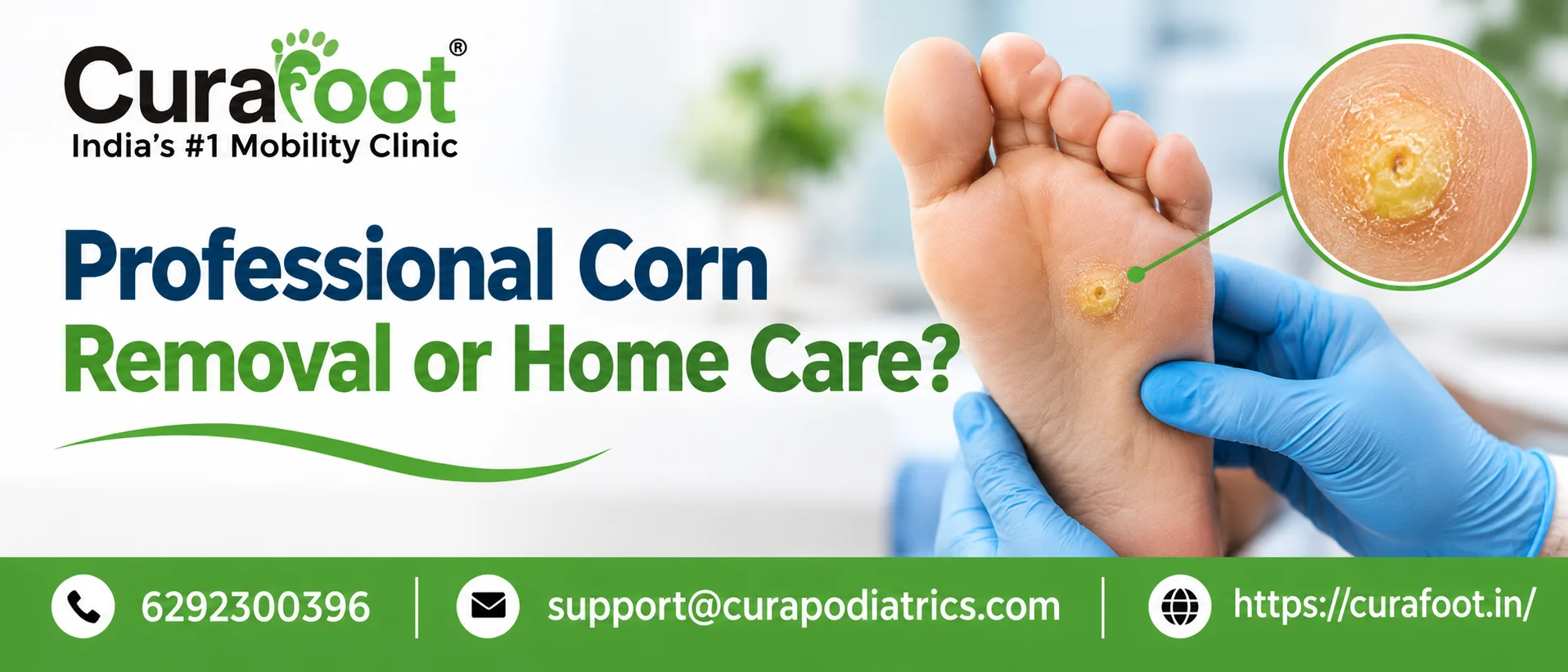 Professional Corn Removal or Home Care?